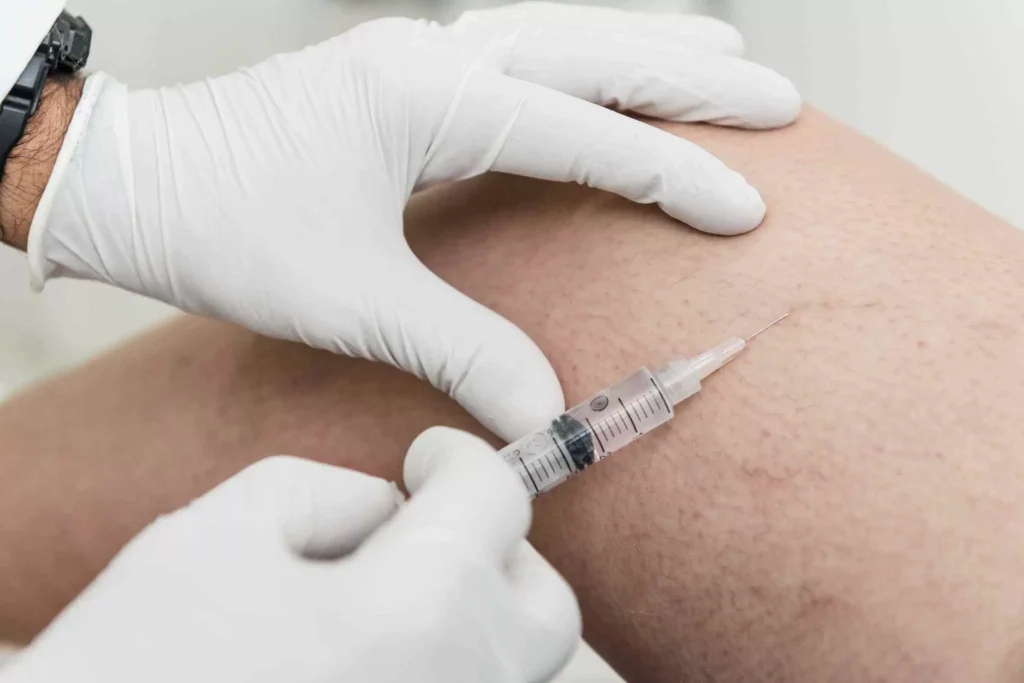 A professional vein treatment doctor performing Sclerotherapy