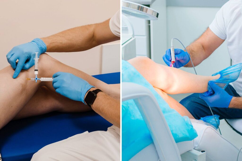 A close-up of legs with spider veins, comparing sclerotherapy and laser therapy treatments.